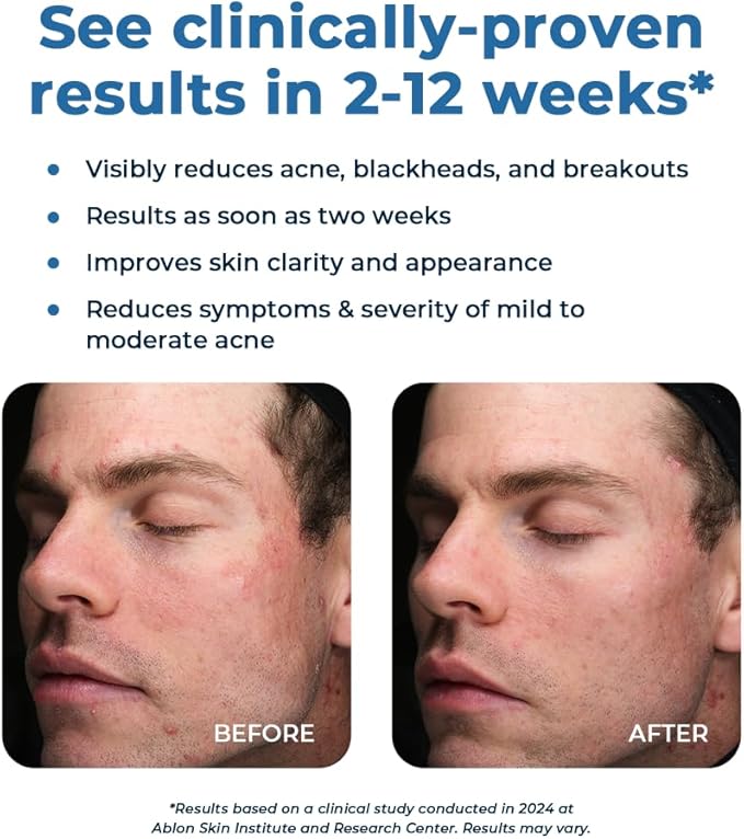 VitaMedica Clear Skin Vitamin Formula 60 Count