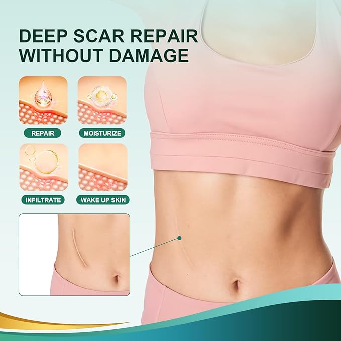 Medical Grade Silicone Scar Sheets, Silicone (1.6”x 60” 60” Roll-1.5M), Roll-1.5M), Professional