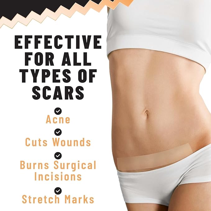 Silicone Scar Patches – Silicone Gel 5 Sheets