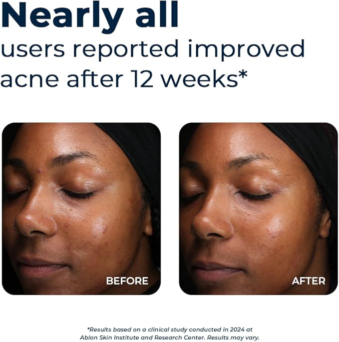 VitaMedica Clear Skin Vitamin Formula 60 Count