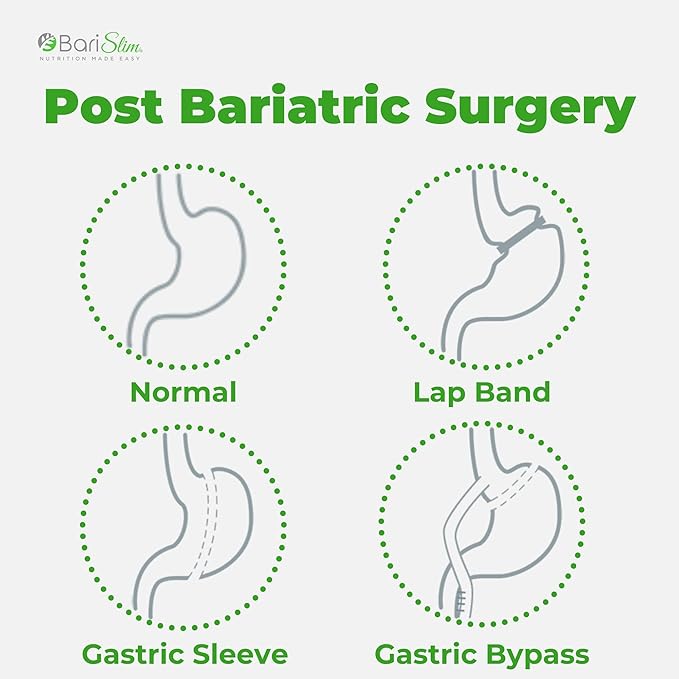 BariSlim Bariatric Calcium Citrate with Magnesium 500 mg (90 Servings)