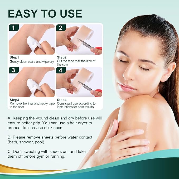 Medical Grade Silicone Scar Sheets, Silicone (1.6”x 60” 60” Roll-1.5M), Roll-1.5M), Professional