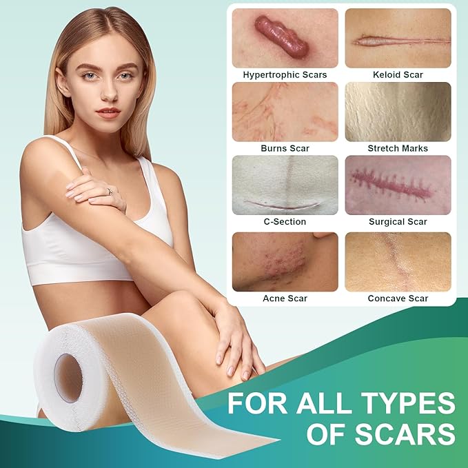 Medical Grade Silicone Scar Sheets, Silicone (1.6”x 60” 60” Roll-1.5M), Roll-1.5M), Professional
