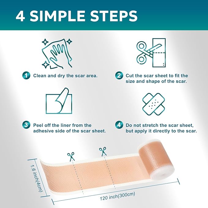 Silicone Scar Sheets, Silicone Scar Tape(1.6"x 120" Roll-300CM), Roll-300CM), Silicone