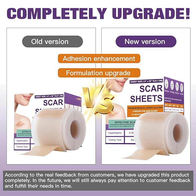 Silicone Scar Sheets,Silicone Scar Tape,Scar Tape Scars(1.6"X 59" 59" Roll-1.5M) Roll-1.5M) Keloid
