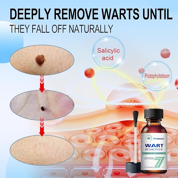 at-Home Skin Tag Remover Kit 17% Salicylic 3333