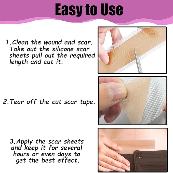 Silicone Scar Tape,(1.6" X 120" Roll-3M)