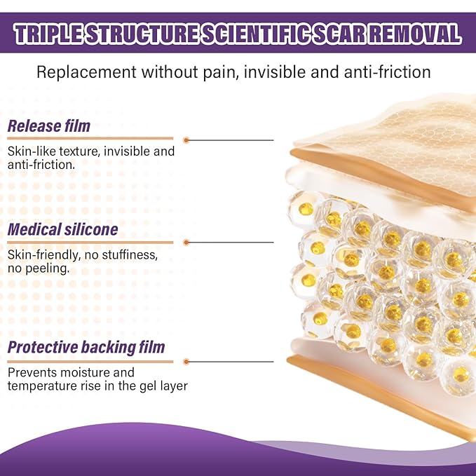 Silicone Scar Sheets,Silicone Scar Tape,Scar Tape Scars(1.6"X 59" 59" Roll-1.5M) Roll-1.5M) Keloid