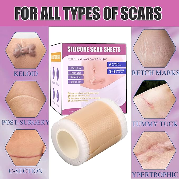 Silicone Scar Tape,(1.6" X 120" Roll-3M)