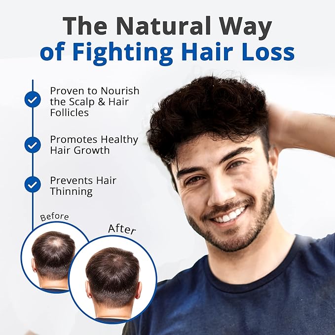 HAIRMETTO Serum for Hair Loss and Regrowth with Saw Palmetto, Stinging Nettle, Rosemary Oils, Peppermint Scent, Unisex,4oz