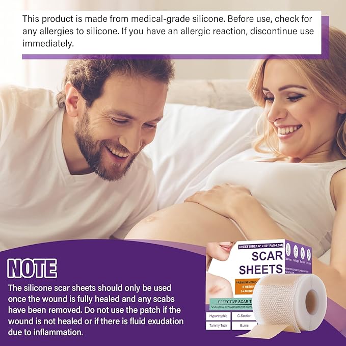 Silicone Scar Sheets,Silicone Scar Tape,Scar Tape Tuck,Keloid(1.6"X 120" 120" Roll-3M) Roll-3M) Keloid