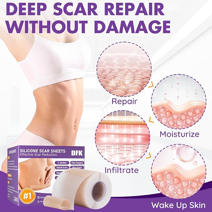 Silicone Scar Sheets, Silicone Scar Tape(1.6"x 79" Roll-2M), Roll-2M), Reusable