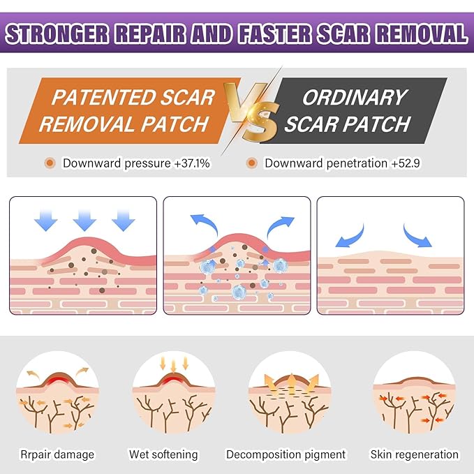 Silicone Scar Sheets,Silicone Scar Tape,Scar Tape Tuck,Keloid(1.6"X 120" 120" Roll-3M) Roll-3M) Keloid