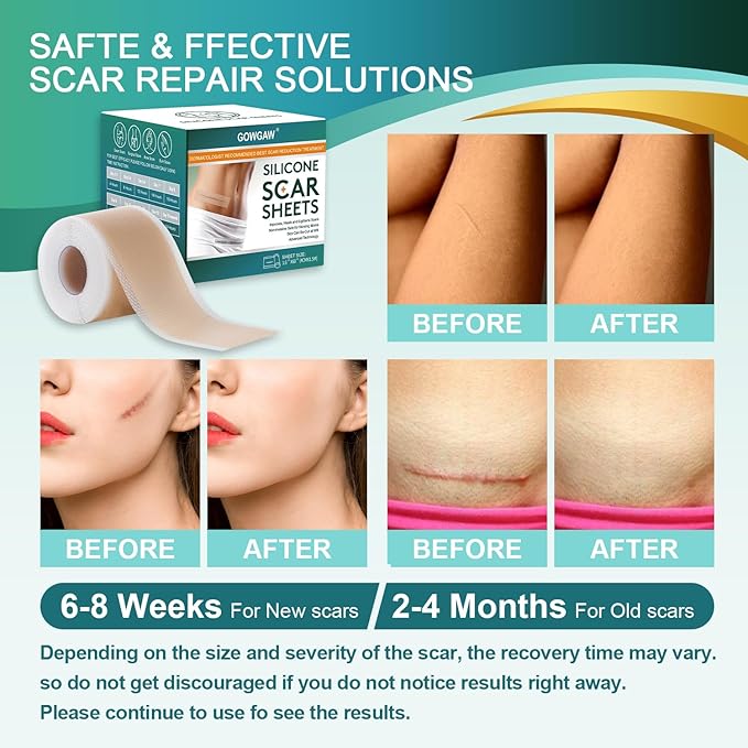 Medical Grade Silicone Scar Sheets, Silicone (1.6”x 60” 60” Roll-1.5M), Roll-1.5M), Professional