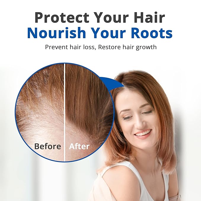HAIRMETTO Serum for Hair Loss and Regrowth with Saw Palmetto, Stinging Nettle, Rosemary Oils, Peppermint Scent, Unisex,4oz