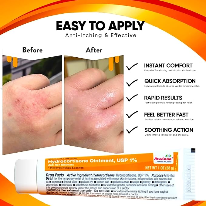 Hydrocortisone Ointment | 1oz Hydrocortisone Ointment 1 Percent