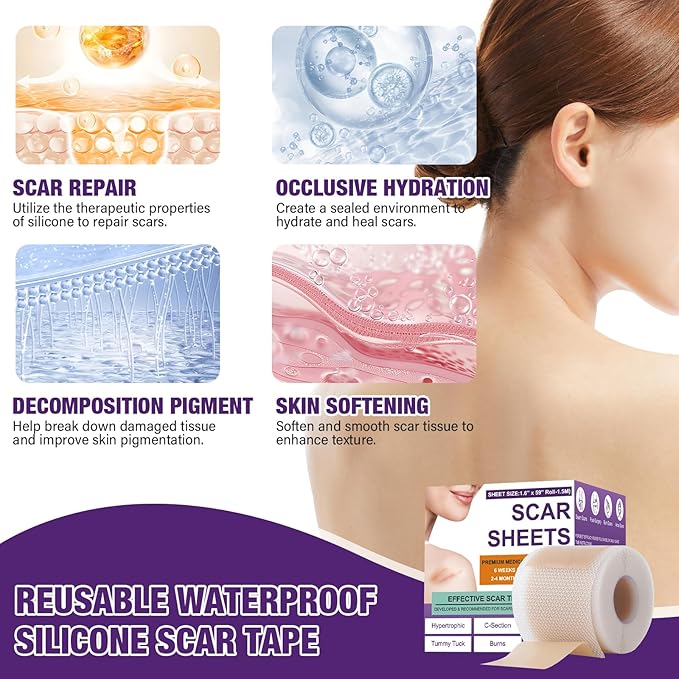 Silicone Scar Sheets,Silicone Scar Tape,Scar Tape Tuck,Keloid(1.6"X 120" 120" Roll-3M) Roll-3M) Keloid