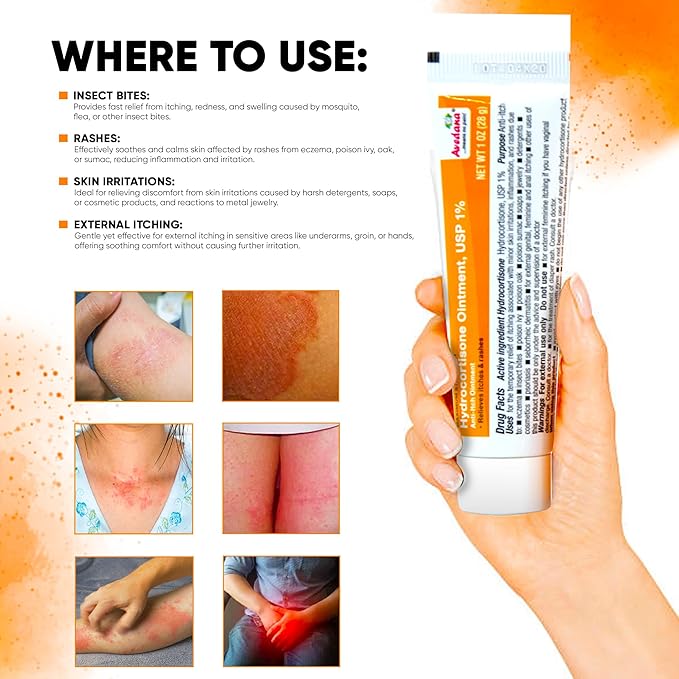 Hydrocortisone Ointment | 1oz Hydrocortisone Ointment 1 Percent