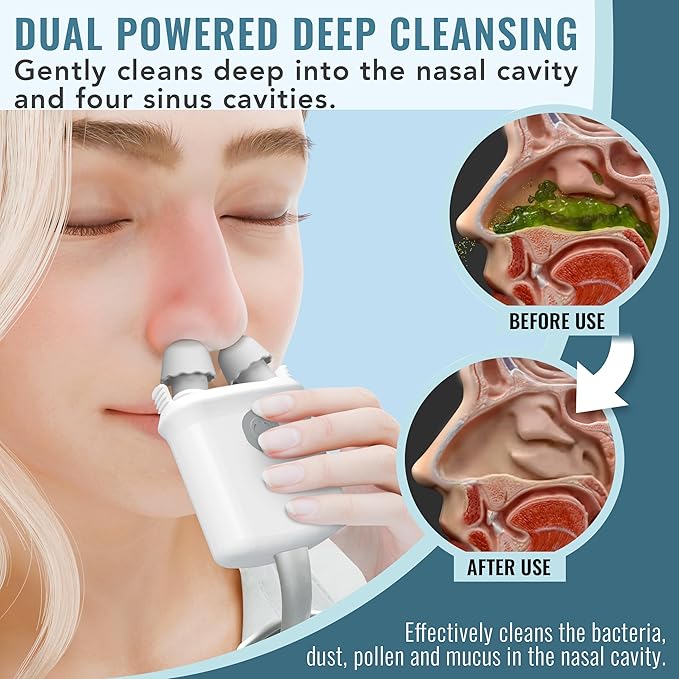 NASALFRESH MD - Dual Powered Nasal -60 Saline 2 Nose
