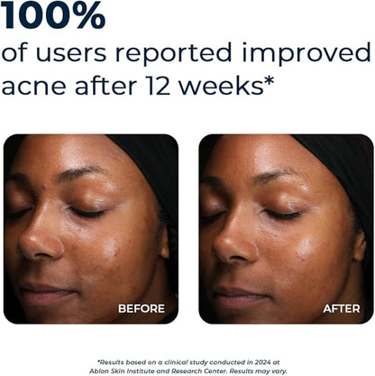 VitaMedica Clear Skin Vitamin Formula 2 Pack