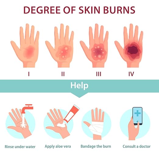 Burn Wound Packing Trainer, Burn Moulage,