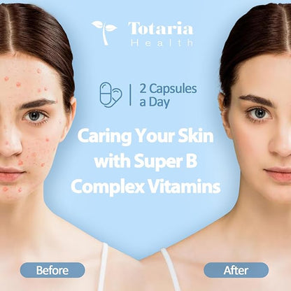 13-in-1 Vitamin B Complex Plus B1, B2, B2, B3 B3 (Niacinamide), B4, B5, B5, B6, B6, B7 B7 (Biotin), B8 (Inositol), B9 (Folate), B12, C, D3, K2 K2 - 120 Vegan