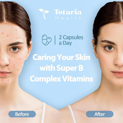 13-in-1 Vitamin B Complex Plus B1, B2, B2, B3 B3 (Niacinamide), B4, B5, B5, B6, B6, B7 B7 (Biotin), B8 (Inositol), B9 (Folate), B12, C, D3, K2 K2 - 120 Vegan