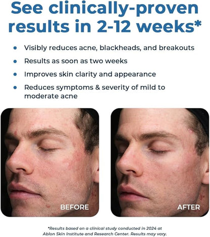 VitaMedica Clear Skin Vitamin Formula 60 Count