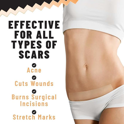 Silicone Scar Patches – Silicone Gel 5 Sheets