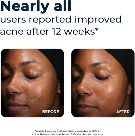 VitaMedica Clear Skin Vitamin Formula 60 Count