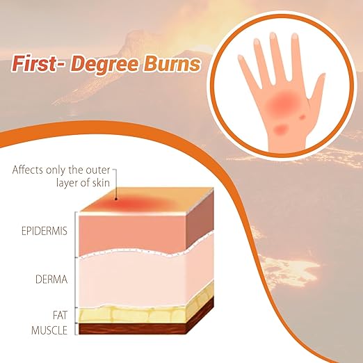 Burn Wound Packing Trainer, Burn Moulage,
