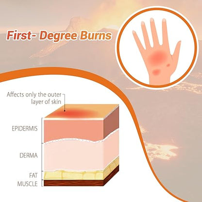 Burn Wound Packing Trainer, Burn Moulage,