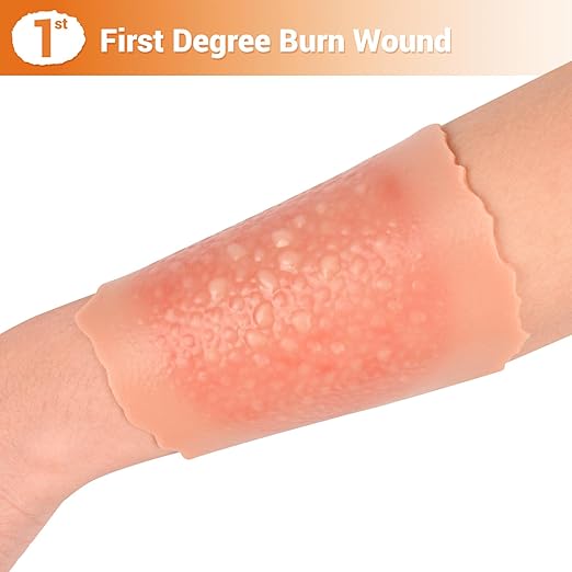 Burn Wound Packing Trainer, Burn Moulage,