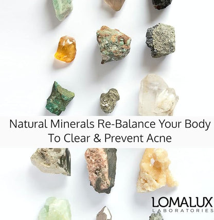 Acne Pill -Natural Skin Clearing Minerals Like Zinc & Sulfur, Dermatologist Developed, Clears & Prevents All Types of Face & Body Acne - NO Harsh Chemicals Like Topical Acne Treatments