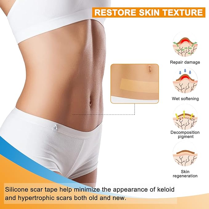 Silicone Scar Sheets Silicone Gel Scar (1.6" x 59"-1.5M) -