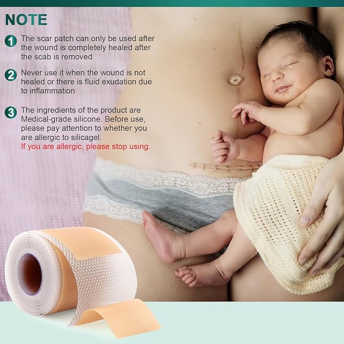 Silicone Scar Sheets,Silicone Scar Tape(1.6"x 120" Roll-3M), Reusable