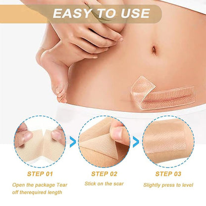 Silicone Scar Sheets,LXIANGN Medical Grade Silicone (1.5”x 120”Roll) 120”Roll)