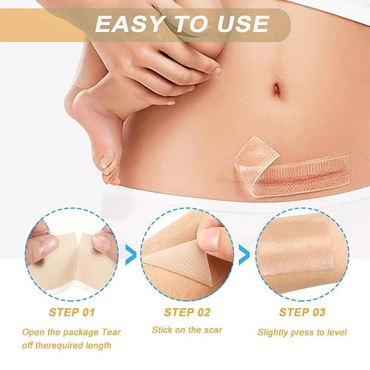 Silicone Scar Sheets,LXIANGN Medical Grade Silicone (1.5”x 120”Roll) 120”Roll)