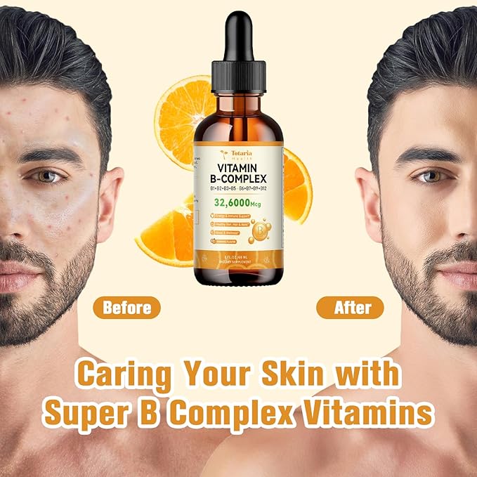 Totatria Vitamin B Complex Liquid Drops 32,6000mcg per B1, B2, B2, B3(Niacin), B3(Niacin), B5, B5, B6, B6, B7(Botin), B7(Botin), B9, B9, B12 B12 for 2 FL.OZ