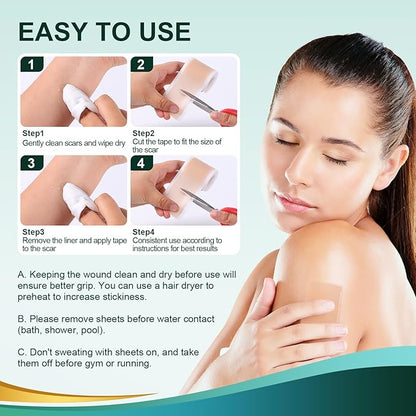 Medical Grade Silicone Scar Sheets, Silicone (1.6”x 60” 60” Roll-1.5M), Roll-1.5M), Professional