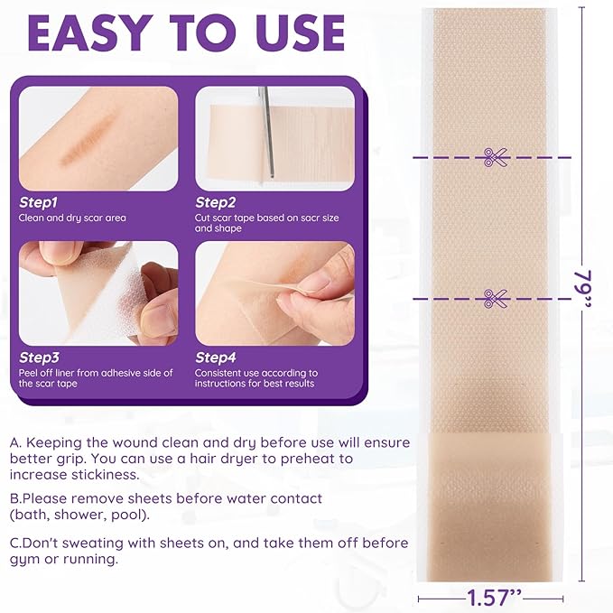 Silicone Scar Sheets, Silicone Scar Tape(1.6"x 79" Roll-2M), Roll-2M), Reusable