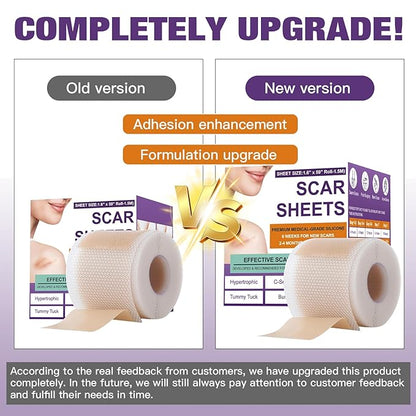 Silicone Scar Sheets,Silicone Scar Tape,Scar Tape Scars(1.6"X 59" 59" Roll-1.5M) Roll-1.5M) Keloid