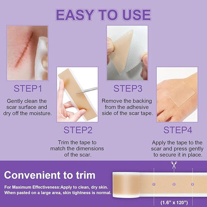 Silicone Scar Sheets, Medical Grade Silicone (1.6" x 120"), Professional