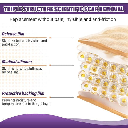 Silicone Scar Sheets,Silicone Scar Tape,Scar Tape Scars(1.6"X 59" 59" Roll-1.5M) Roll-1.5M) Keloid