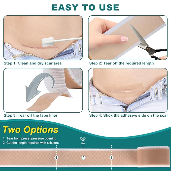 Silicone Scar Sheets, Silicone Scar Tape(1.6"x 118" Roll-3M), Roll-3M), Reusable
