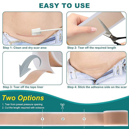 Silicone Scar Sheets, Silicone Scar Tape(1.6"x 118" Roll-3M), Roll-3M), Reusable