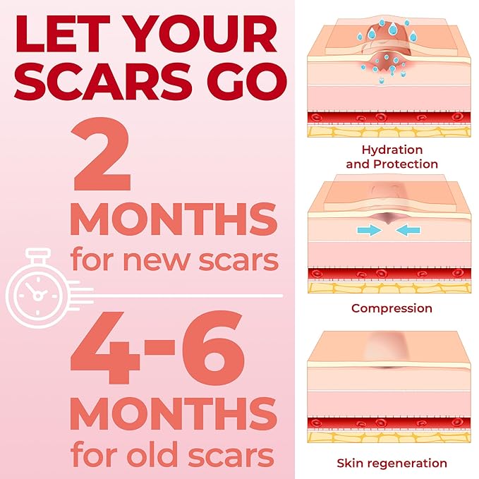 Medical Grade Silicone Scar Sheets 6pk (7”x1.6”) (7”x1.6”) -