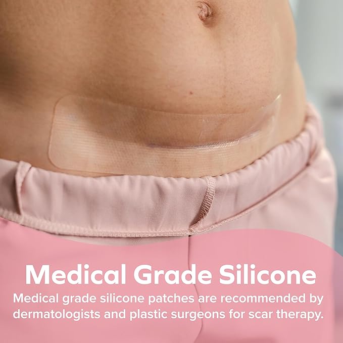 Dr. Talbot's Mom Stretch Mark & 6 Strips (60-Day Supply)