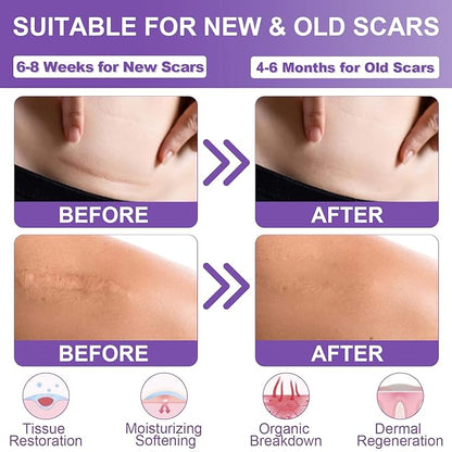Silicone Scar Sheets, Medical Grade Silicone (1.6" x 120"), Professional