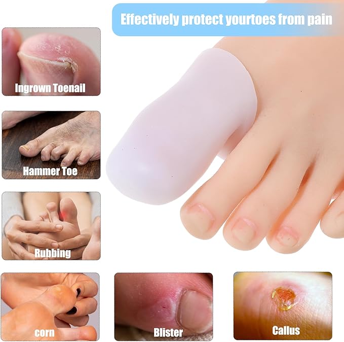 10 Pack Extra Large Silicone Toe
